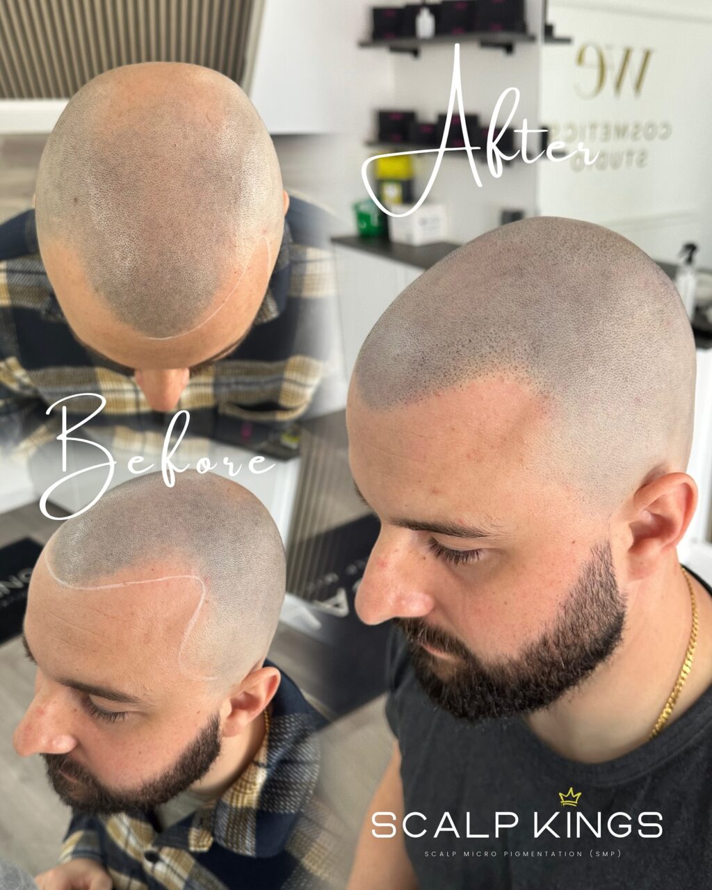 Instagram post from scalpkings. This post is in position 8.