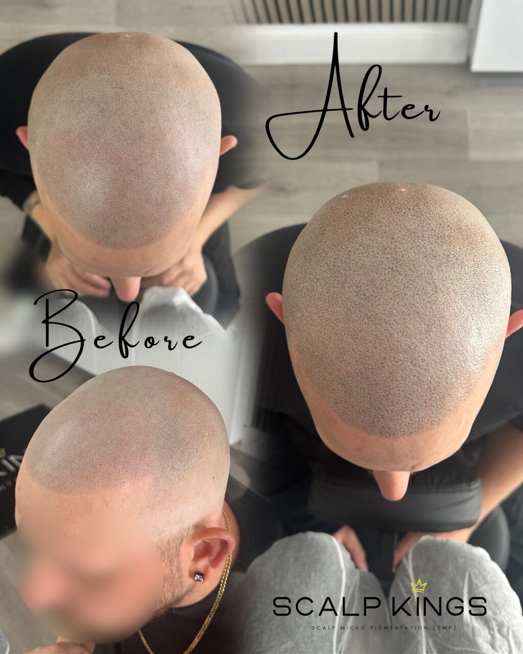 Instagram post from scalpkings. This post is in position 6.