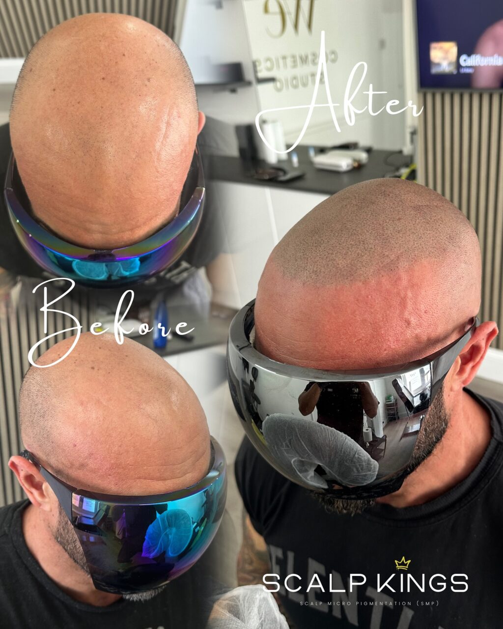 Instagram post from scalpkings. This post is in position 10.